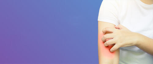 Is hard water slecht voor je huid?